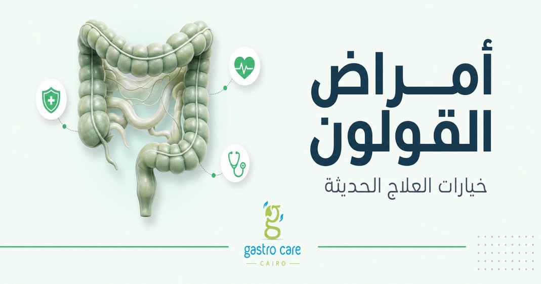 الدليل الشامل لتأمين منزلك بكاميرات المراقبة الذكية